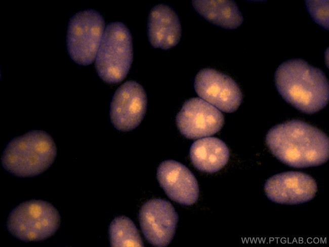 SSRP1 Antibody in Immunocytochemistry (ICC/IF)