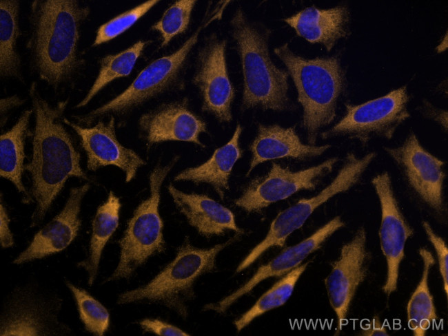 LARS Antibody in Immunocytochemistry (ICC/IF)