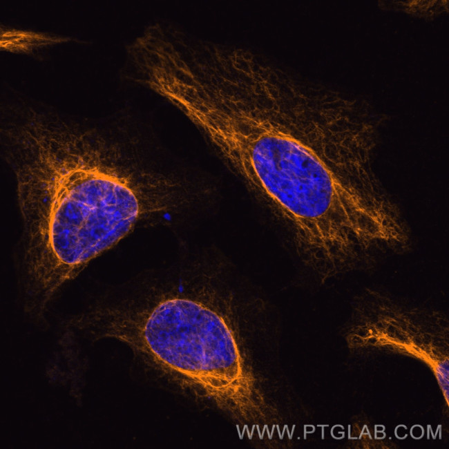 Vimentin Antibody in Immunocytochemistry (ICC/IF)