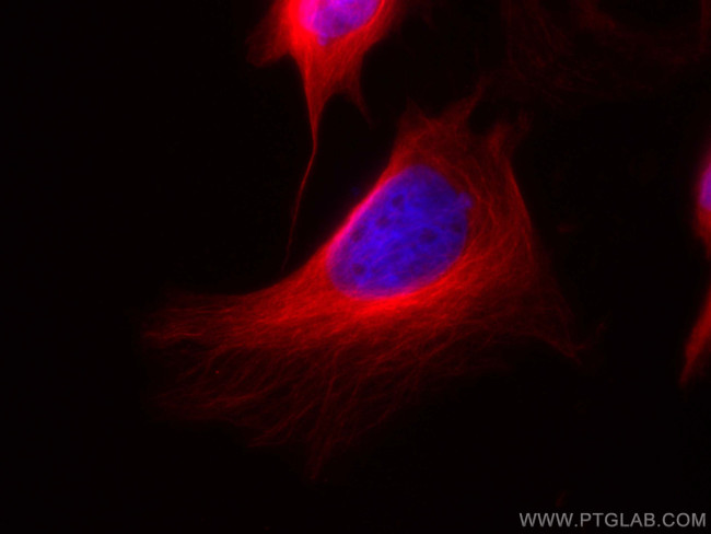 Beta Tubulin Antibody in Immunocytochemistry (ICC/IF)