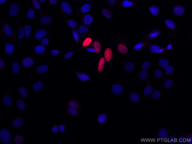 P21 Antibody in Immunocytochemistry (ICC/IF)