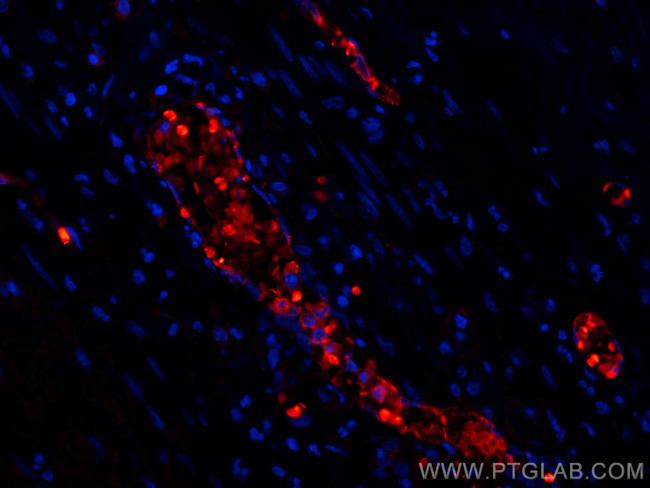 Hemoglobin Alpha Antibody in Immunohistochemistry (PFA fixed) (IHC (PFA))
