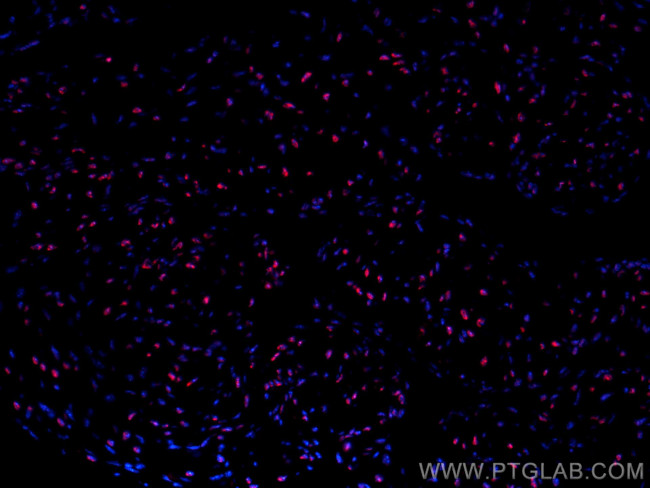 SF3B3 Antibody in Immunohistochemistry (PFA fixed) (IHC (PFA))