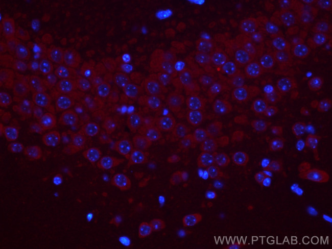 GPR37/Pael-R Antibody in Immunohistochemistry (PFA fixed) (IHC (PFA))