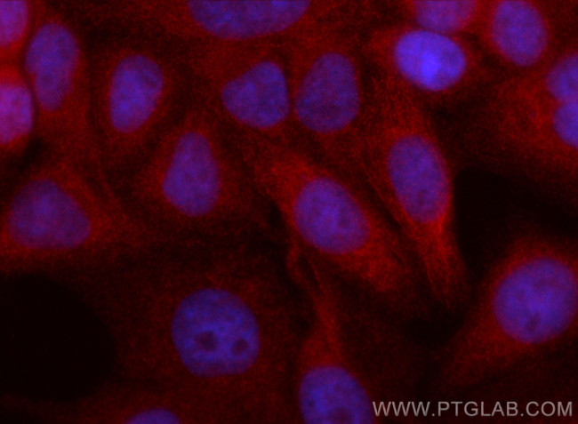 NLRX1 Antibody in Immunocytochemistry (ICC/IF)