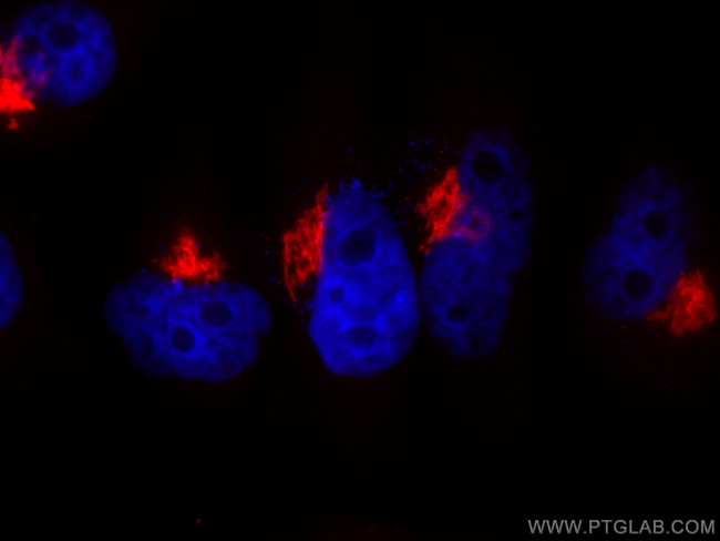 GALNT2 Antibody in Immunocytochemistry (ICC/IF)