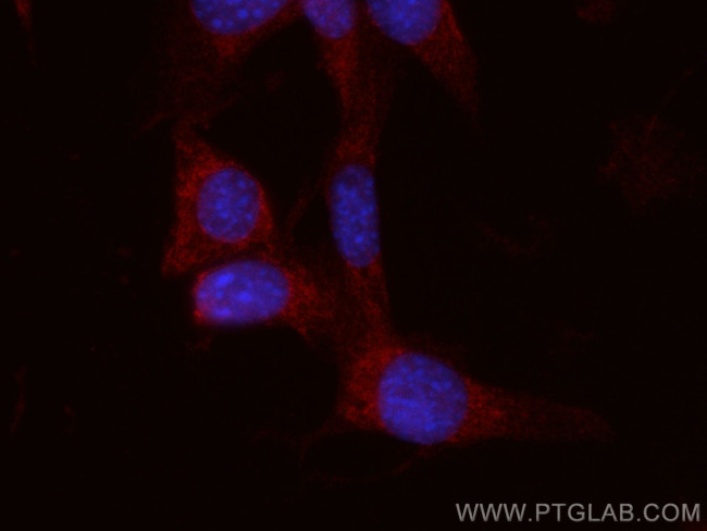 C1QBP Antibody in Immunocytochemistry (ICC/IF)