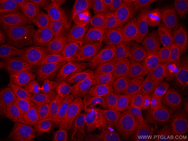 STOML2 Antibody in Immunocytochemistry (ICC/IF)