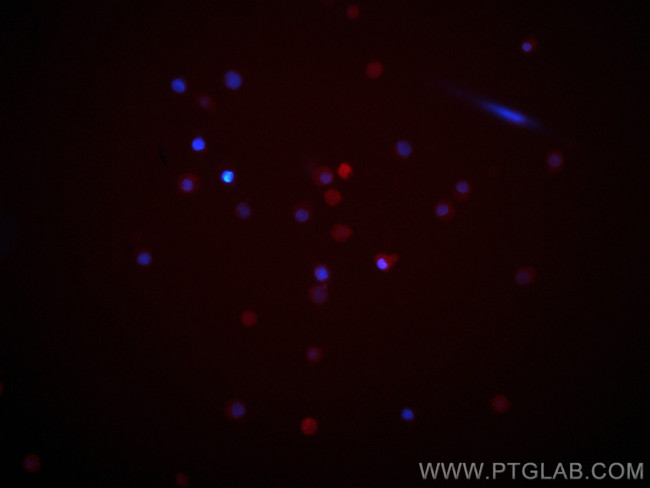 CXCR3B Antibody in Immunocytochemistry (ICC/IF)