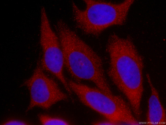 GDI2 Antibody in Immunocytochemistry (ICC/IF)