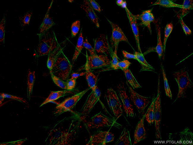 ITM2C Antibody in Immunocytochemistry (ICC/IF)