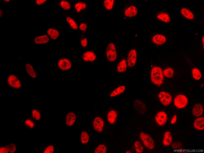 FUS/TLS Antibody in Immunocytochemistry (ICC/IF)