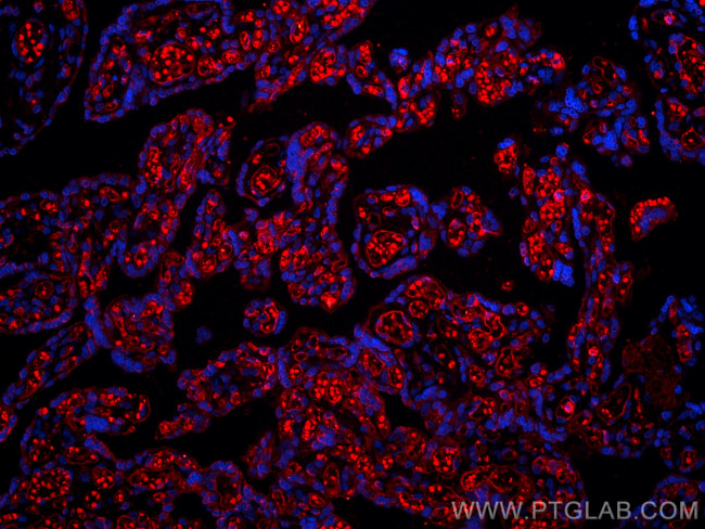 CD34 Antibody in Immunohistochemistry (PFA fixed) (IHC (PFA))