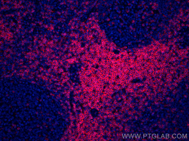 CD3 Antibody in Immunohistochemistry (PFA fixed) (IHC (PFA))
