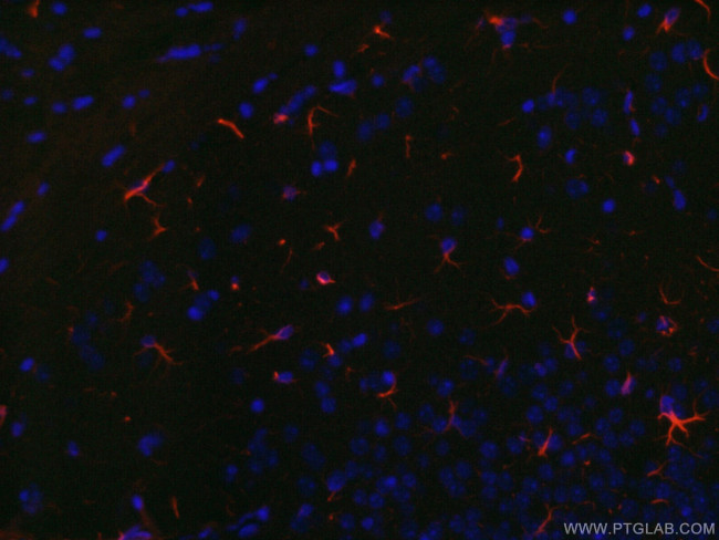 GFAP Antibody in Immunohistochemistry (PFA fixed) (IHC (PFA))