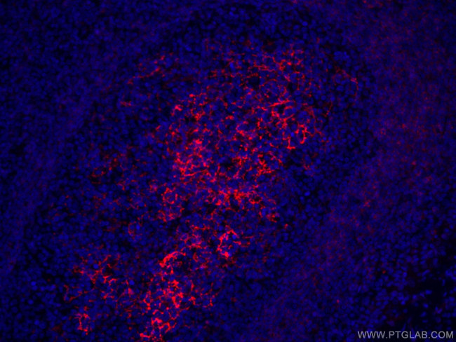 CD23 Antibody in Immunohistochemistry (PFA fixed) (IHC (PFA))