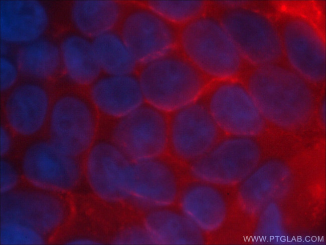 CD44 Antibody in Immunocytochemistry (ICC/IF)