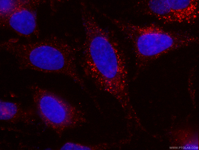Cytoglobin Antibody in Immunocytochemistry (ICC/IF)
