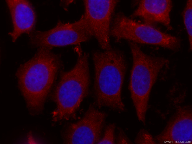 COTL1 Antibody in Immunocytochemistry (ICC/IF)