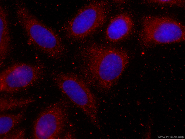 FAM3C Antibody in Immunocytochemistry (ICC/IF)