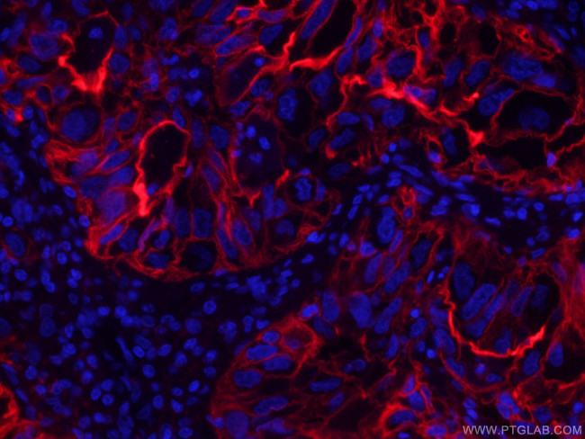 ICAM-1 Antibody in Immunohistochemistry (PFA fixed) (IHC (PFA))