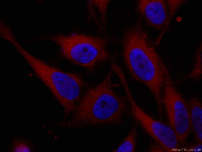VCP Antibody in Immunocytochemistry (ICC/IF)