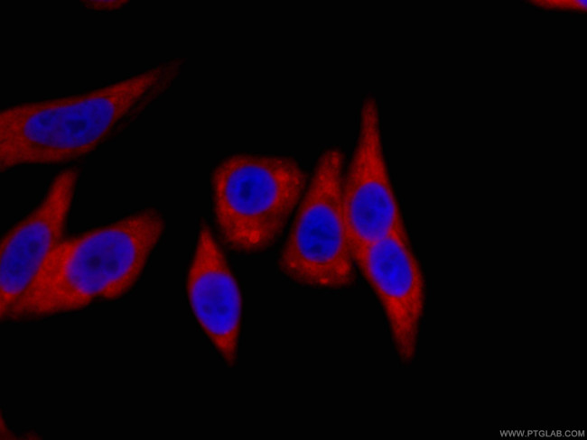 HSP90 Antibody in Immunocytochemistry (ICC/IF)