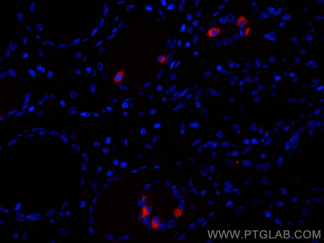 Gastrin Antibody in Immunohistochemistry (PFA fixed) (IHC (PFA))