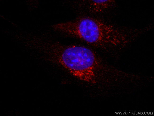 CD107a/LAMP1 Antibody in Immunocytochemistry (ICC/IF)