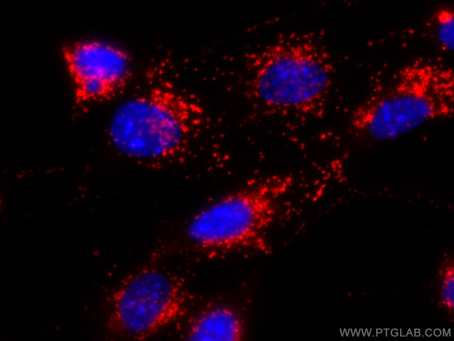 CD107b/LAMP2 Antibody in Immunocytochemistry (ICC/IF)