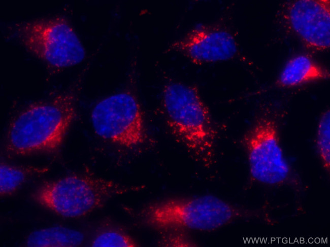CD107b/LAMP2 Antibody in Immunocytochemistry (ICC/IF)