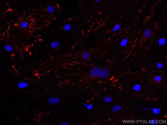 CD31 Antibody in Immunocytochemistry (ICC/IF)