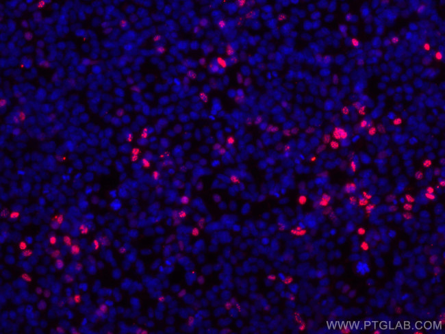 HA Tag Antibody in Immunocytochemistry (ICC/IF)