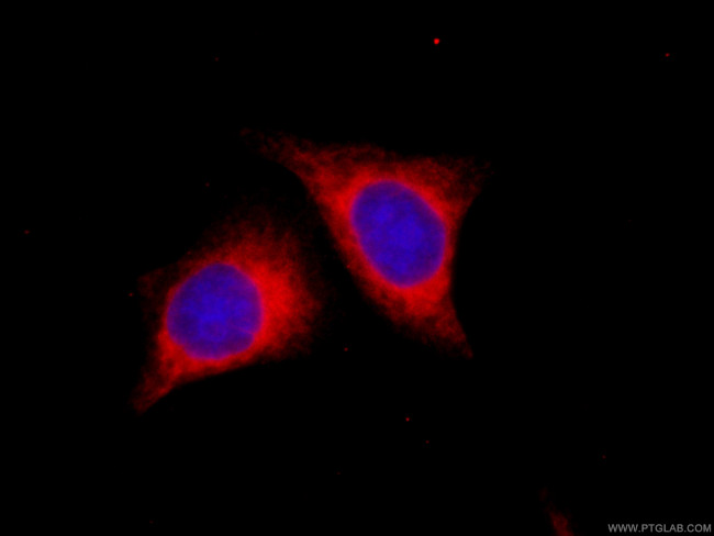 CYB5R3 Antibody in Immunocytochemistry (ICC/IF)