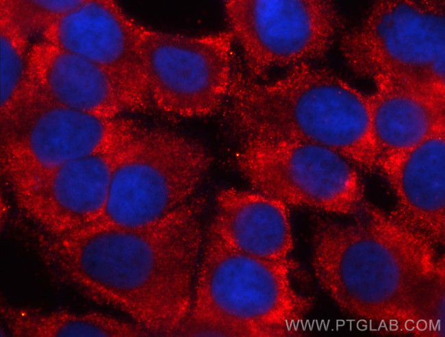 EIF3M Antibody in Immunocytochemistry (ICC/IF)