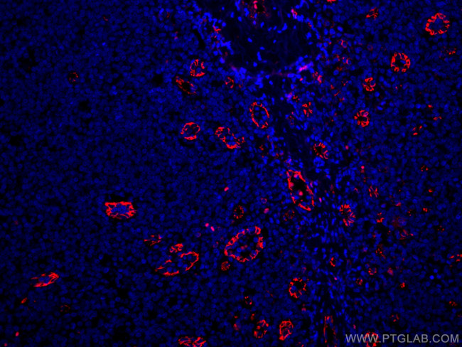 CD31 Antibody in Immunohistochemistry (PFA fixed) (IHC (PFA))
