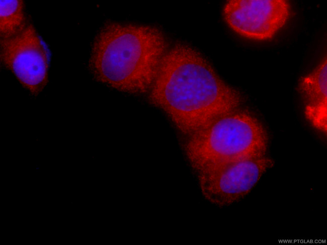 EPLIN Antibody in Immunocytochemistry (ICC/IF)