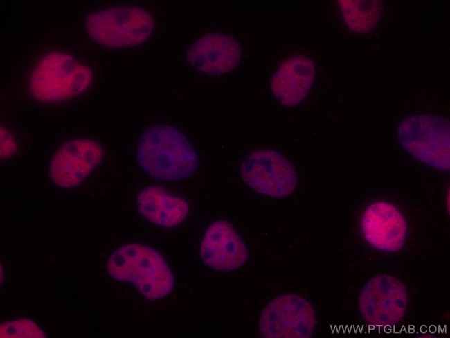 HDAC1 Antibody in Immunocytochemistry (ICC/IF)