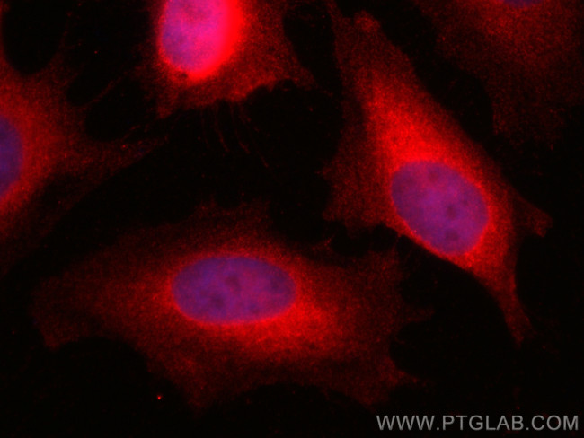UBE2C Antibody in Immunocytochemistry (ICC/IF)