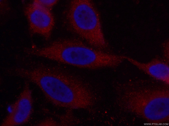Caspase 8/p43/p18 Antibody in Immunocytochemistry (ICC/IF)