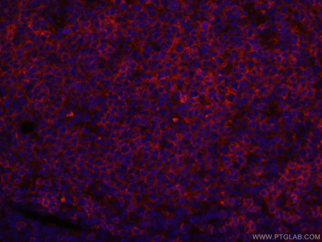 CD22 Antibody in Immunohistochemistry (PFA fixed) (IHC (PFA))