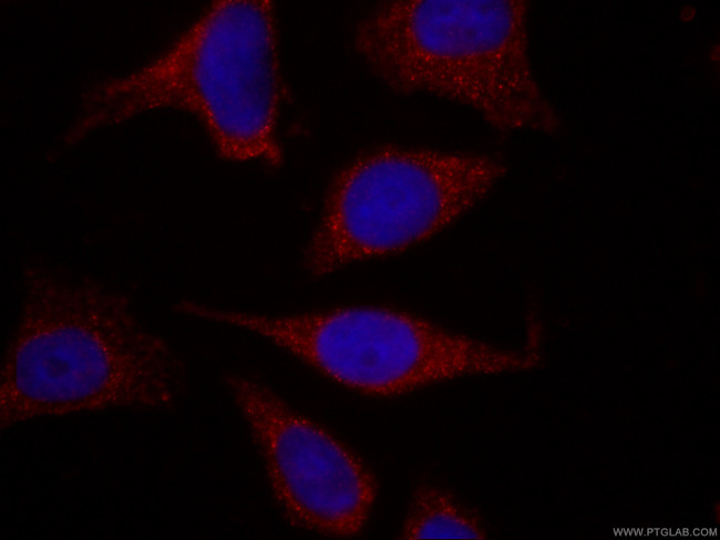APOL1-Specific Antibody in Immunocytochemistry (ICC/IF)