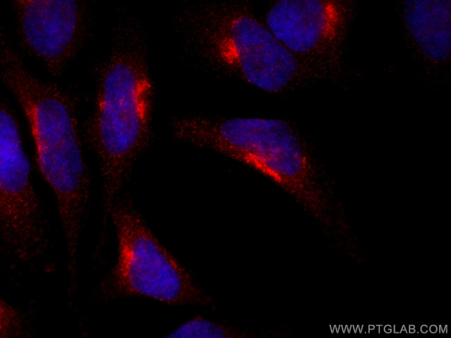RCAS1 Antibody in Immunocytochemistry (ICC/IF)