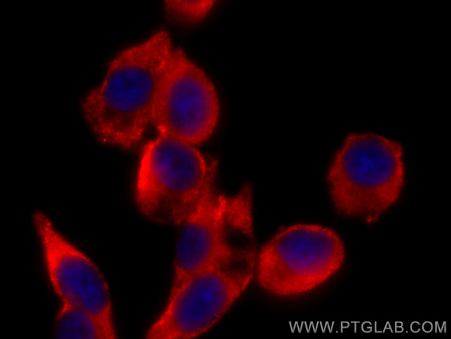 Zinc Alpha 2 Glycoprotein Antibody in Immunocytochemistry (ICC/IF)