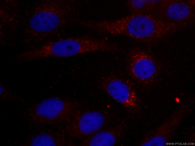 IDH1 Antibody in Immunocytochemistry (ICC/IF)