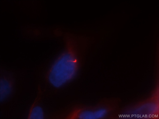 acetylated Tubulin(Lys40) Antibody in Immunocytochemistry (ICC/IF)