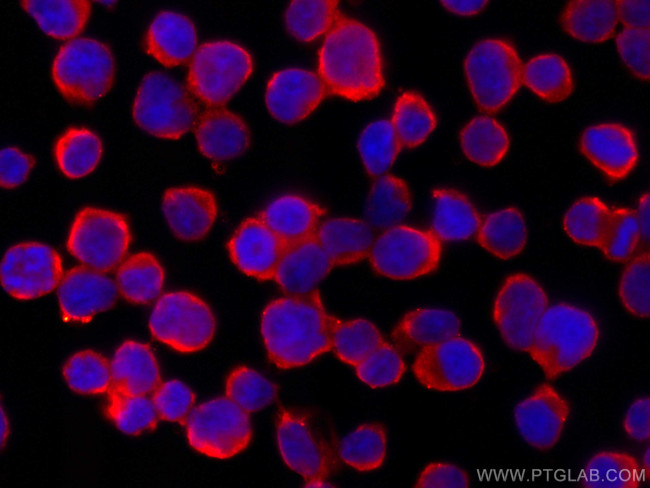 JNK Antibody in Immunocytochemistry (ICC/IF)