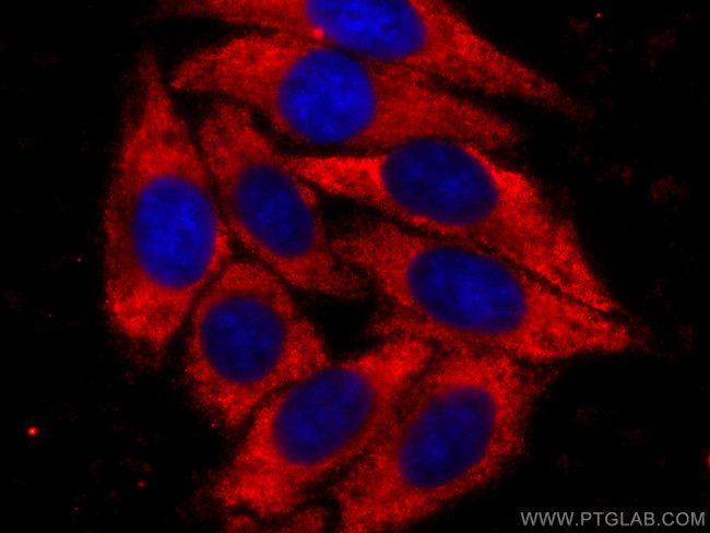 ORM2 Antibody in Immunocytochemistry (ICC/IF)