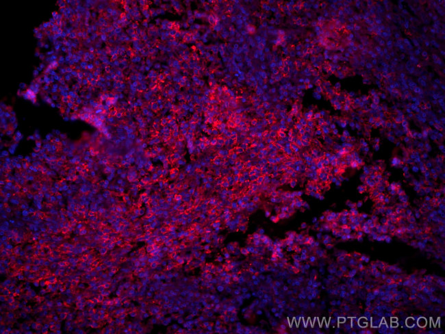 PD-1/CD279 Antibody in Immunohistochemistry (PFA fixed) (IHC (PFA))