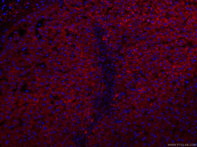 CRP Antibody in Immunohistochemistry (PFA fixed) (IHC (PFA))
